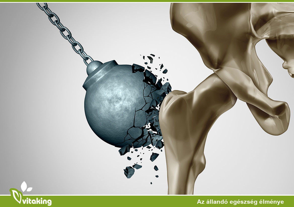 Egészséges Csontok? Megmutatjuk, Mi Segíthet!
